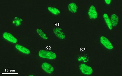 Bromodeoxyuridine labelled S phase cells.